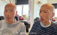 明报OL：78岁余子明痰多吞嚥困难入院